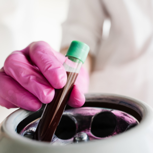 Concentrated PRP